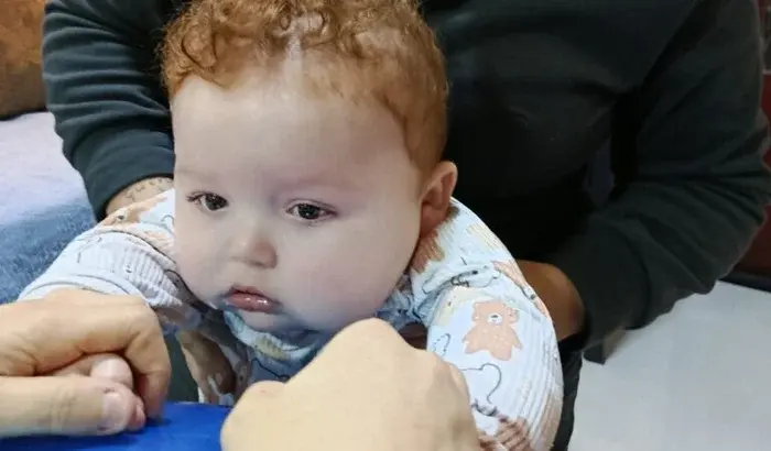 Urgent Help Needed for Nora's Aggressive Facial Cancer