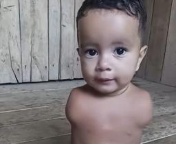 Help Jhonata Get Prosthetic Arms After Medical Neglect
