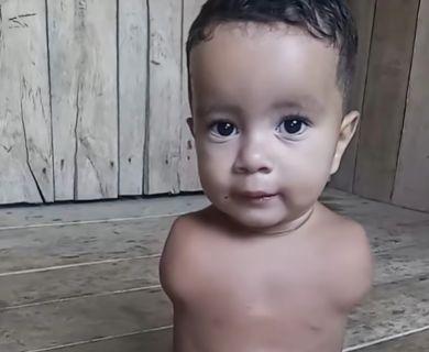 Help Jhonata Get Prosthetic Arms After Medical Neglect