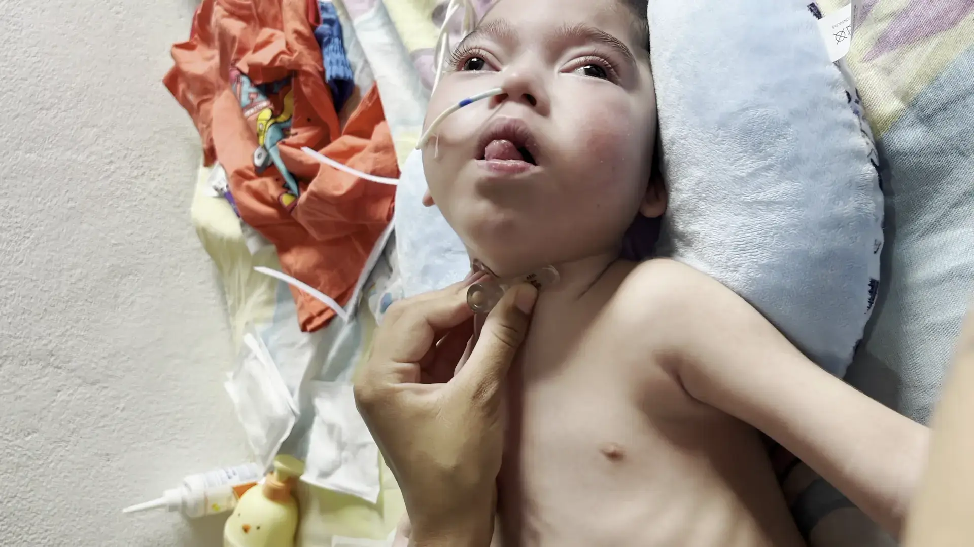 Help Matheus Fight Centronuclear Myopathy
