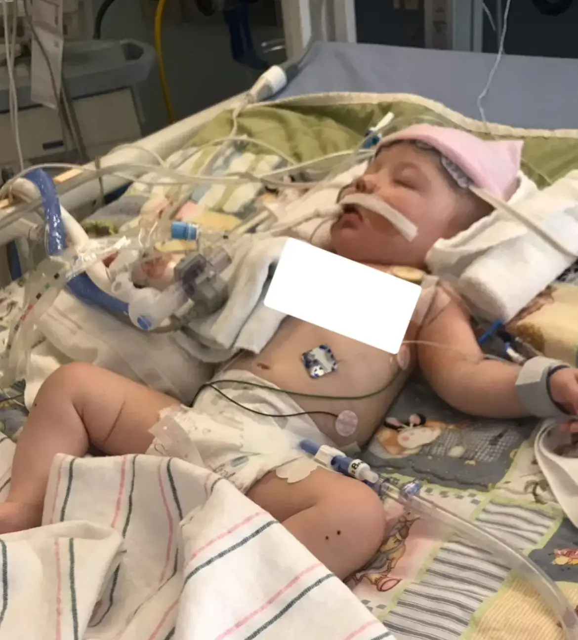 Help Christa To Get A Surgery And Post Traumatic Treatments
